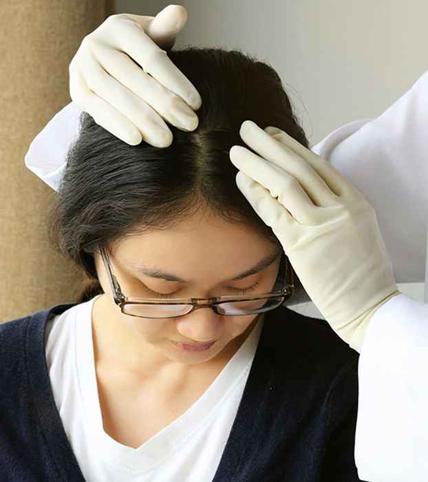 6 Beste DHT -Blocker -Lebensmittel für Haarausfall und Tipps zur Reduzierung