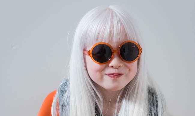 La mia esperienza adotta un bambino con l'albinismo